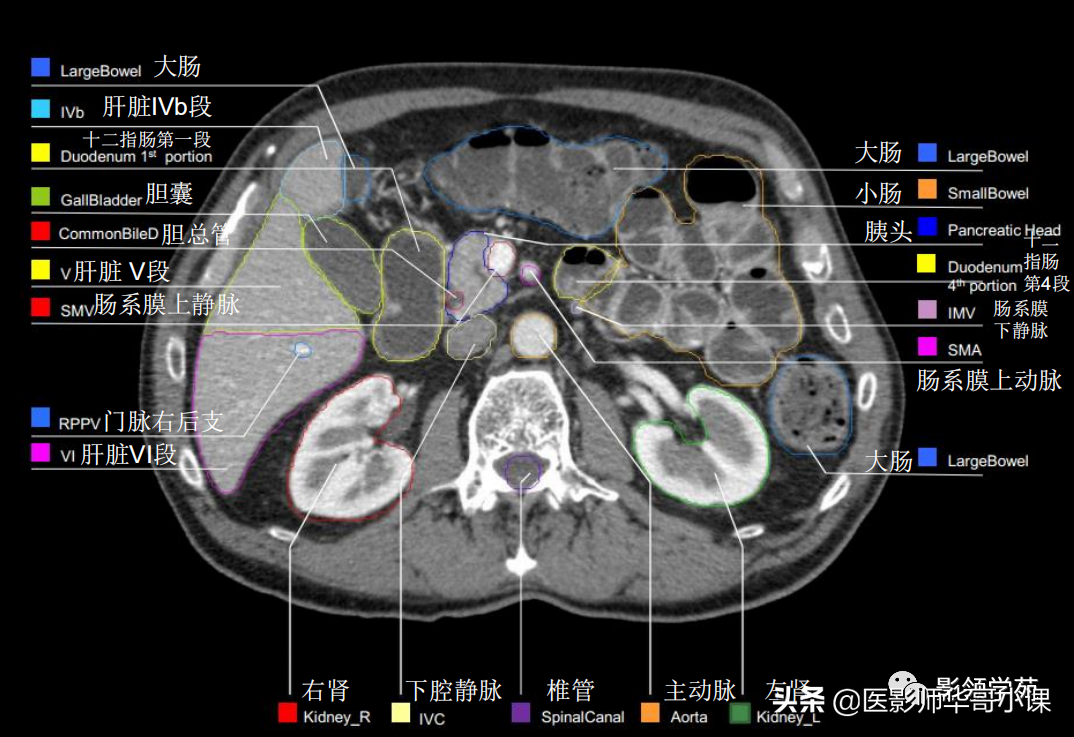 肝脏分段ct示意图图片