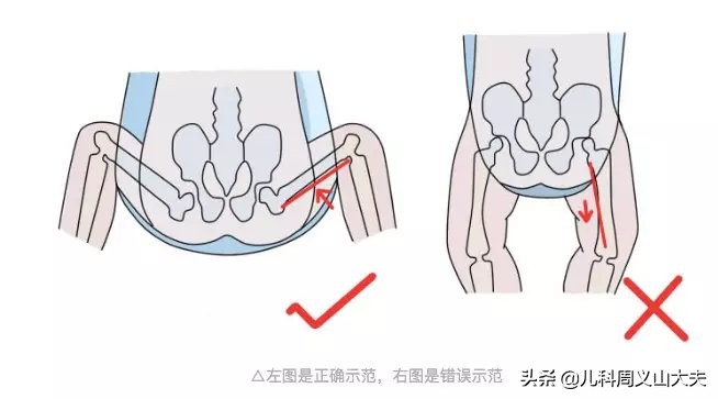 儿科医生提醒使用腰凳带娃出门，关注两点：保护娃的脊椎和髋关节