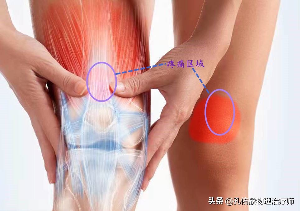 膝关节疼痛是怎么回事？常见的6个部位、8大病因，不可忽视