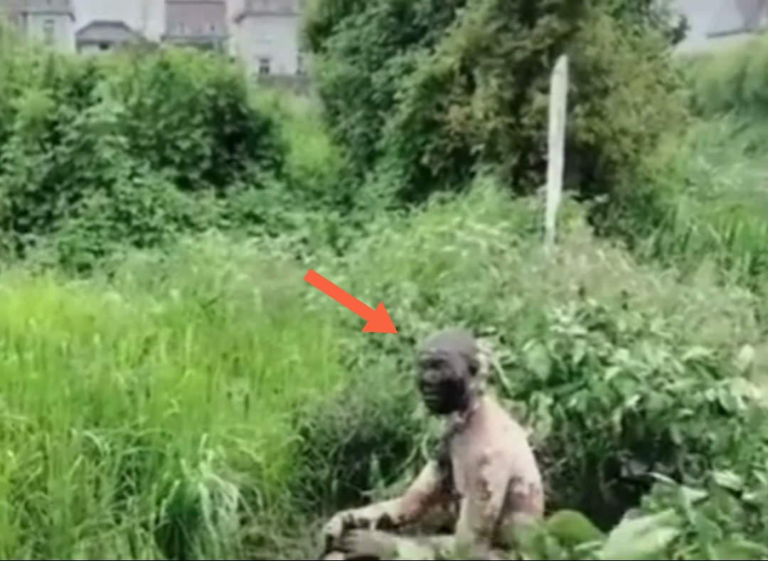 嘉兴男子钓鱼触碰高压电，衣服和头发都烧没了，脸变漆黑