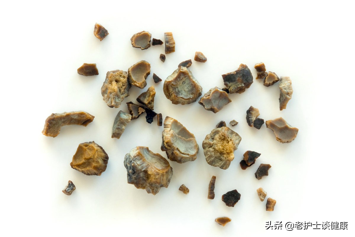 肾结石剧烈疼痛应急处理方法