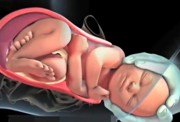 生孩子顺产正面(8张图带你了解顺产全过程,隔着屏幕都觉得疼,宝宝也很