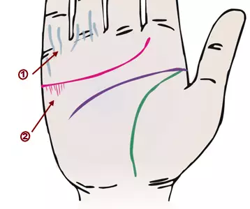 掌纹诊病：可以诊断肝癌、糖尿病、高血压、妇科病、脑溢血