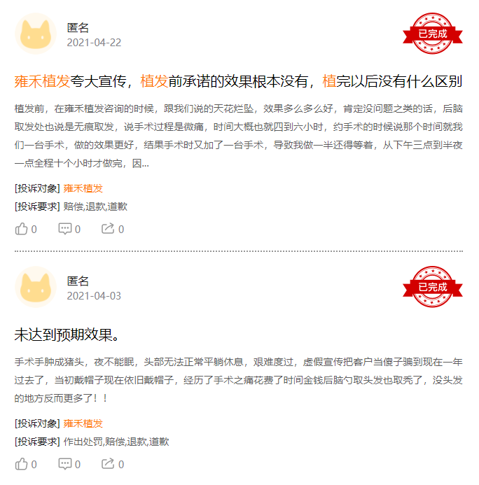 华晨宇被爆植发背后：中国有2.5亿人脱发，90后开始秃了