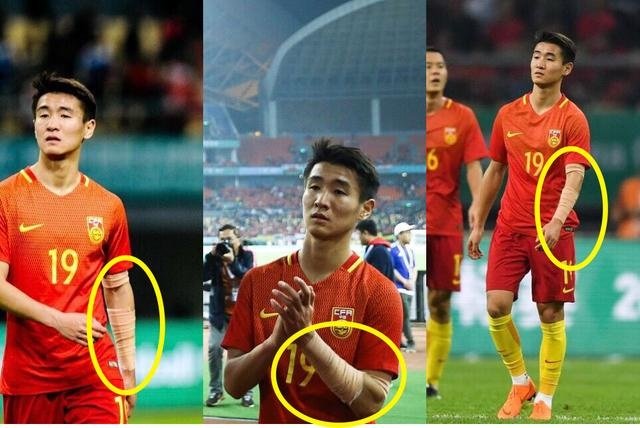 张琳芃纹身能彻底洗掉吗张琳芃纹身