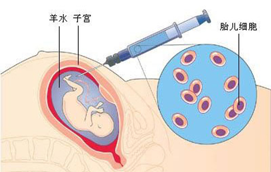 你了解单纯疱疹病毒吗？有可能感染胎儿造成畸形