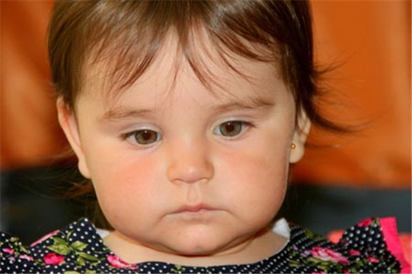 新生儿黄疸值多少算正常？宝宝有黄疸家人需要怎么做？