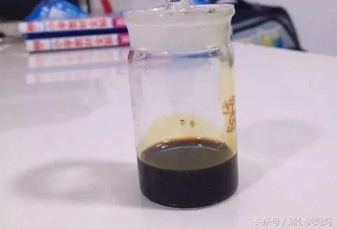 蛋黄油的做法（哺乳期妈妈的必备良器详讲）