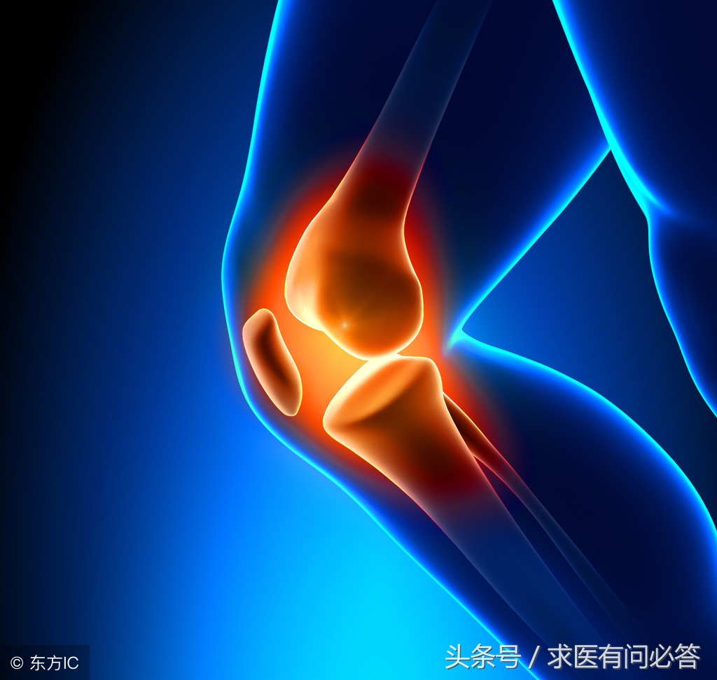 滑膜炎是怎么引起的，都有什么症状？饮食及治疗方法