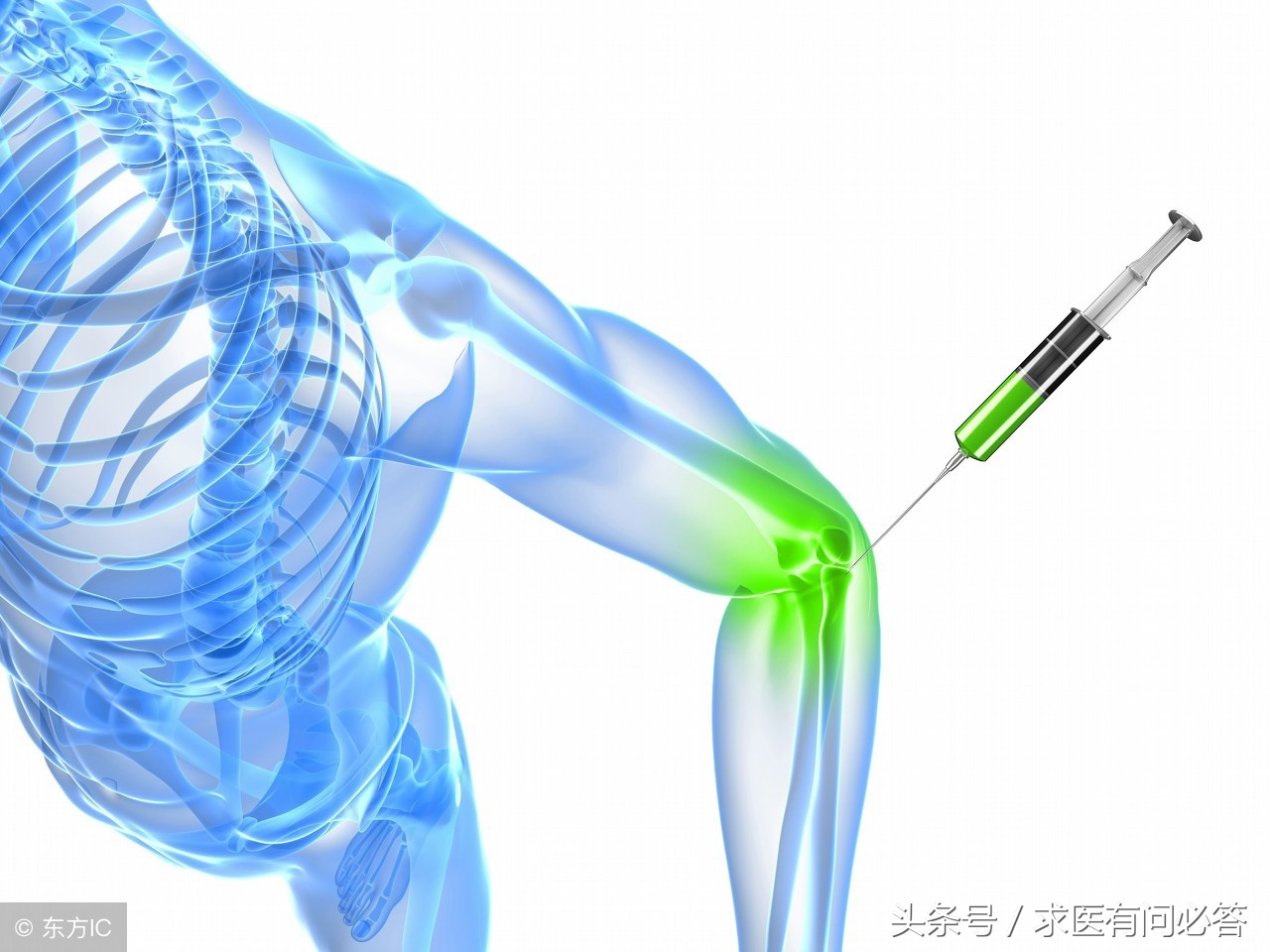 滑膜炎是怎么引起的，都有什么症状？饮食及治疗方法