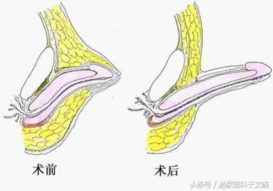 如何增大阴茎(打飞和实战感觉一样吗)-万川快讯