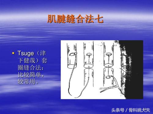 筋断了还能接上？接上了还能跟没受伤一样动？外科手术真神奇