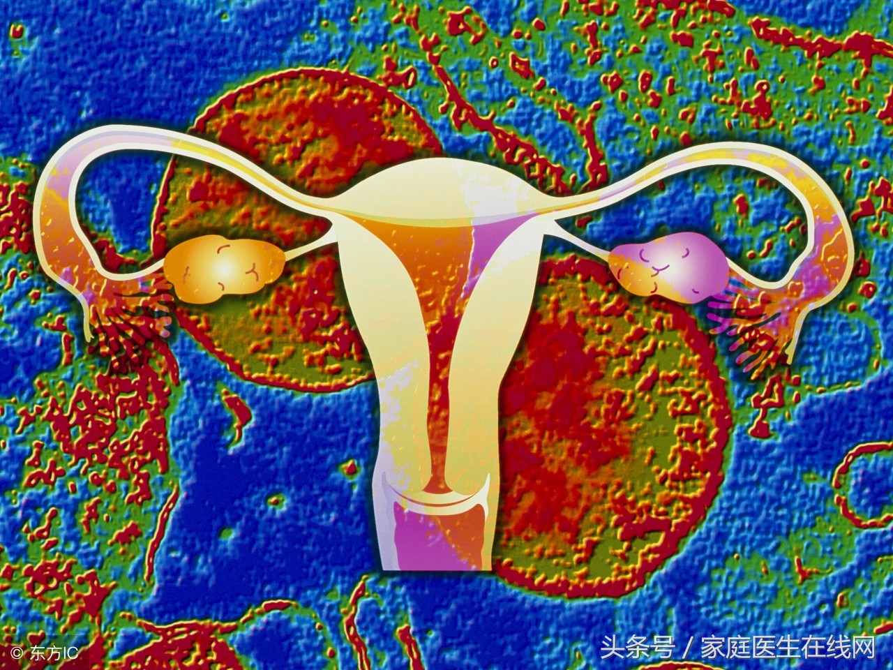 宫颈炎的成因及女性患病原因分析