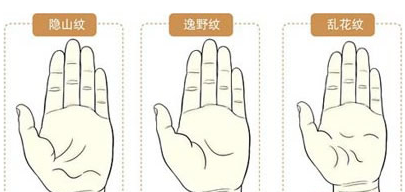 手相解密：史上那种掌纹最罕见