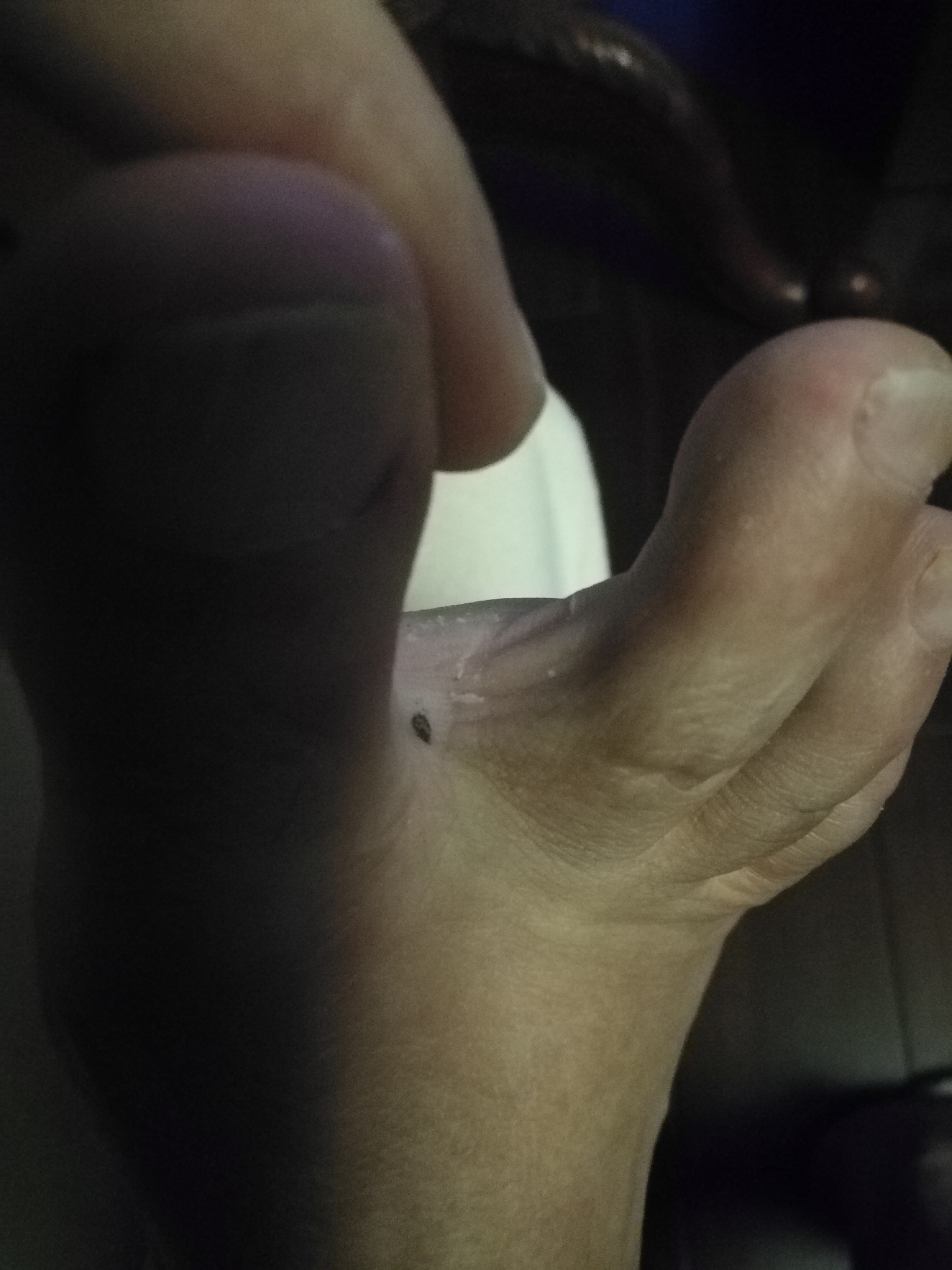 相术：图解——脚上长痣