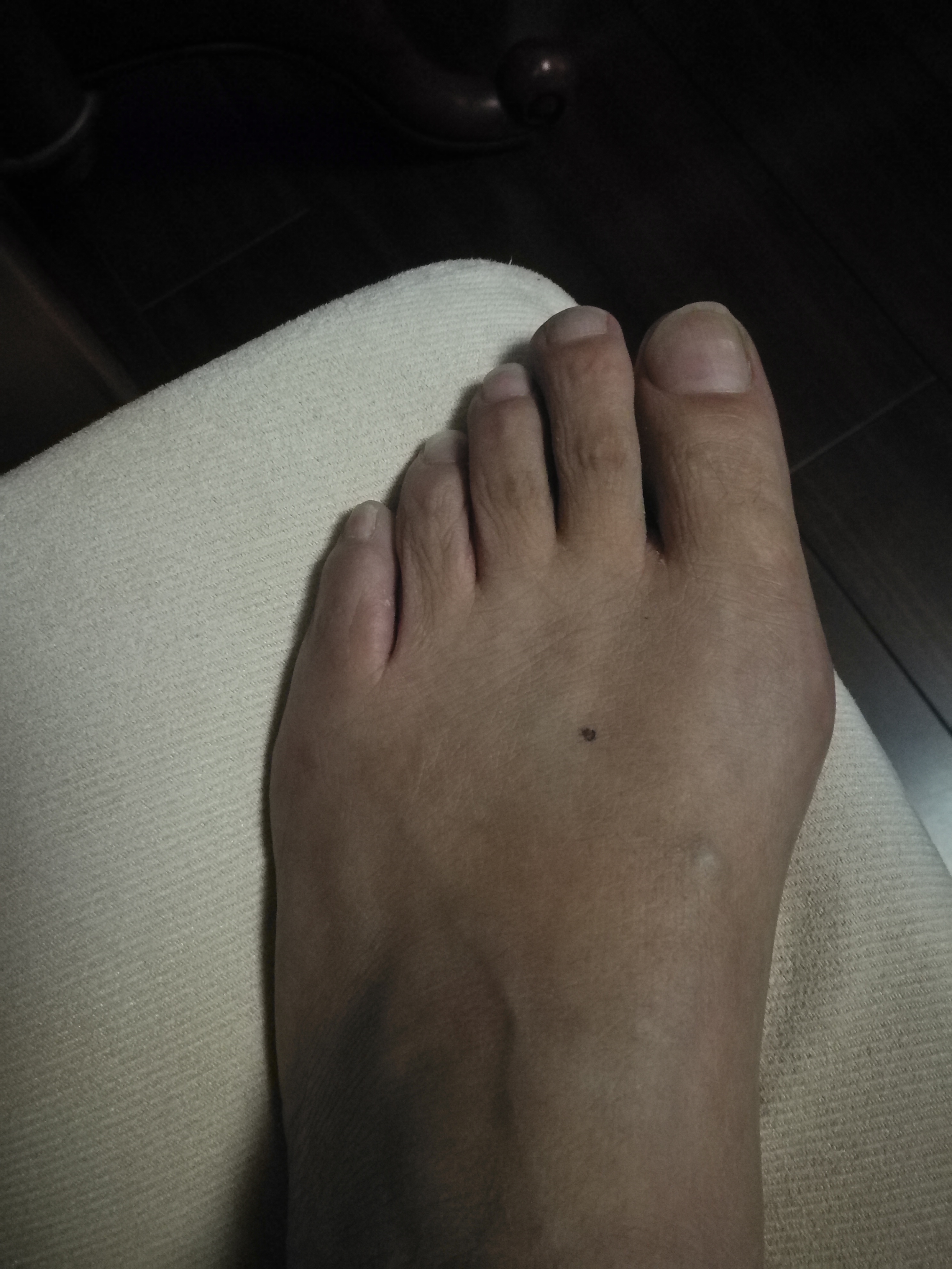 相术：图解——脚上长痣