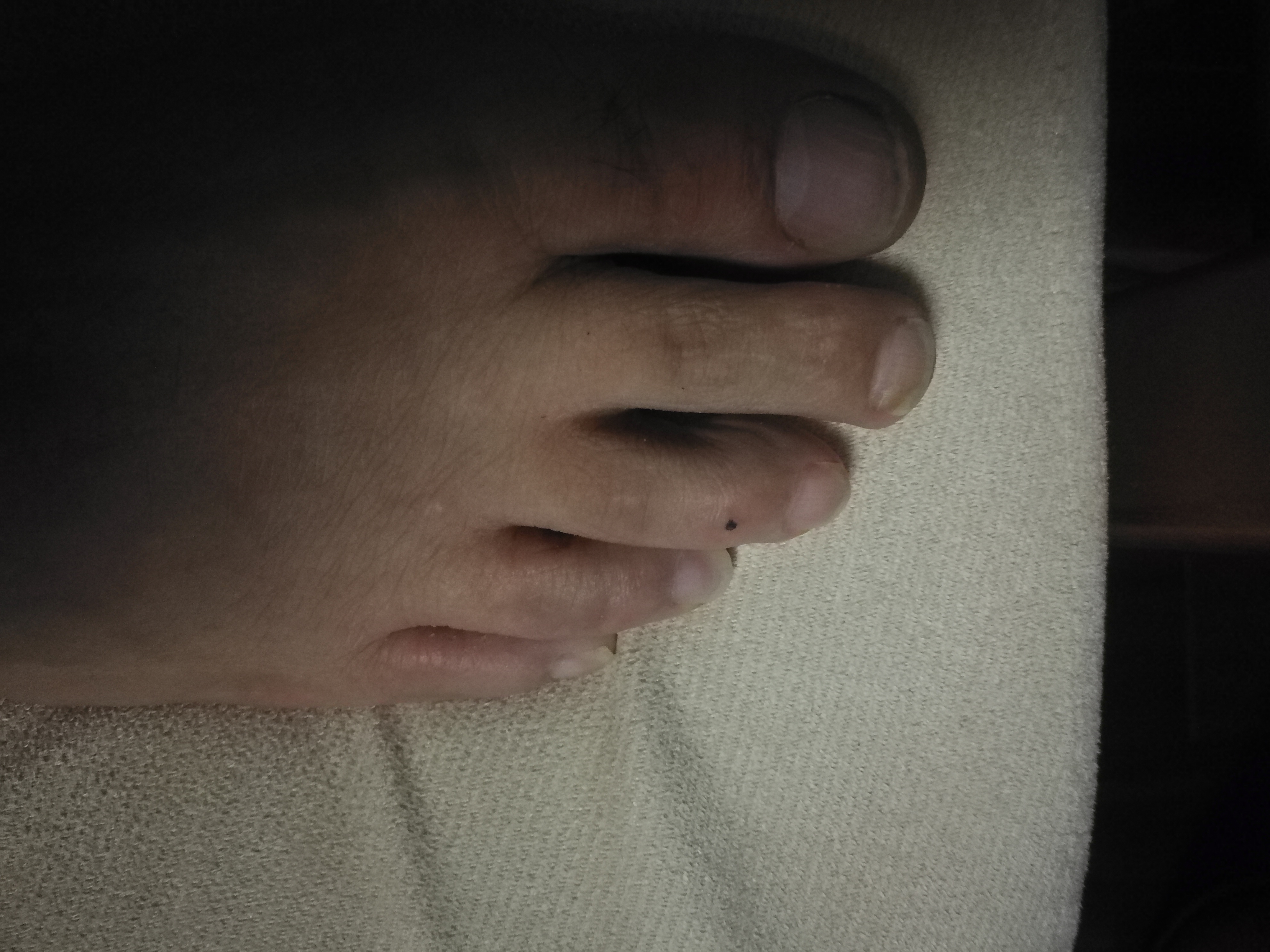 相术：图解——脚上长痣