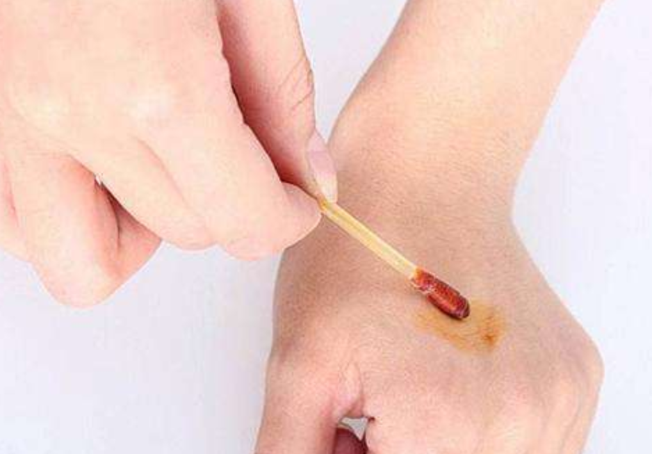 医院打针前涂的"黄色药水"是什么?这消毒液如何正确在家使用?