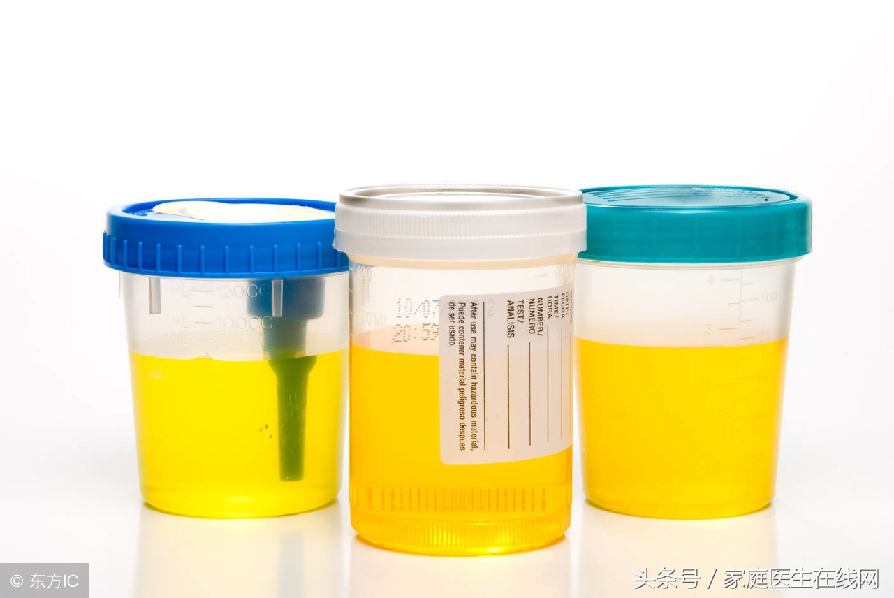 舌尖红、小便黄，可能只是这个小毛病，不用大惊小怪