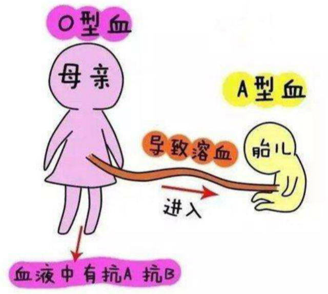 产检时，让孕妈做这项检查的医生，都是坑钱的……