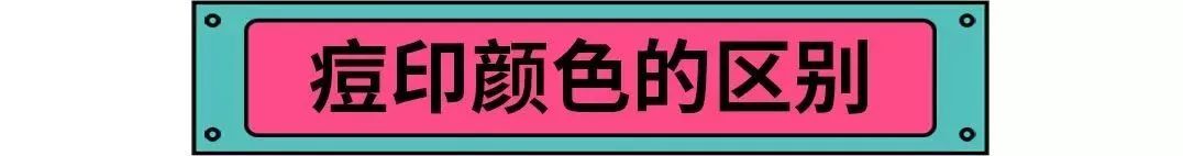 怎样消除痘印又快又有效？那些你不知道的祛痘妙招全公开！