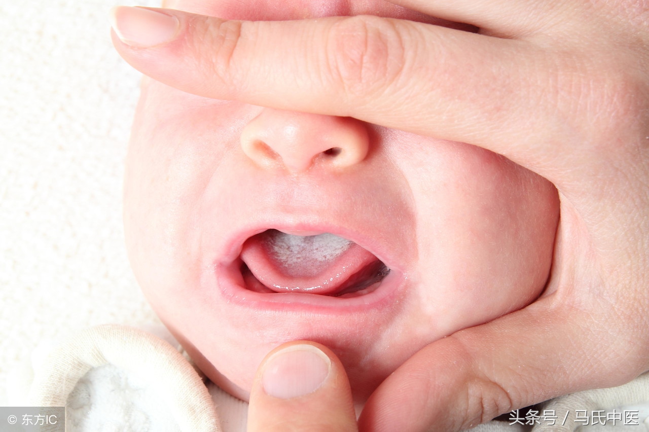 舌苔白是什么原因