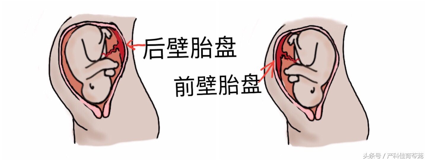 教您看懂产科超声报告