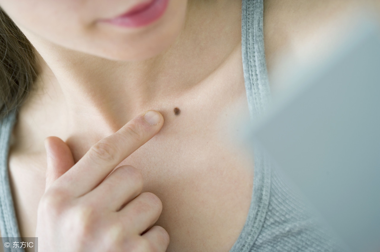 女人脸上的痣好坏图解 头顶有痣运气好化凶厄_达一风水网