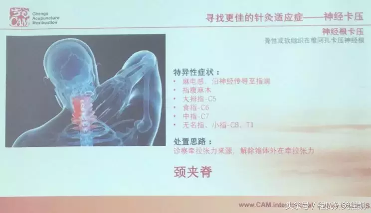 参加程氏针灸培训班，菜鸟学以致用见成效