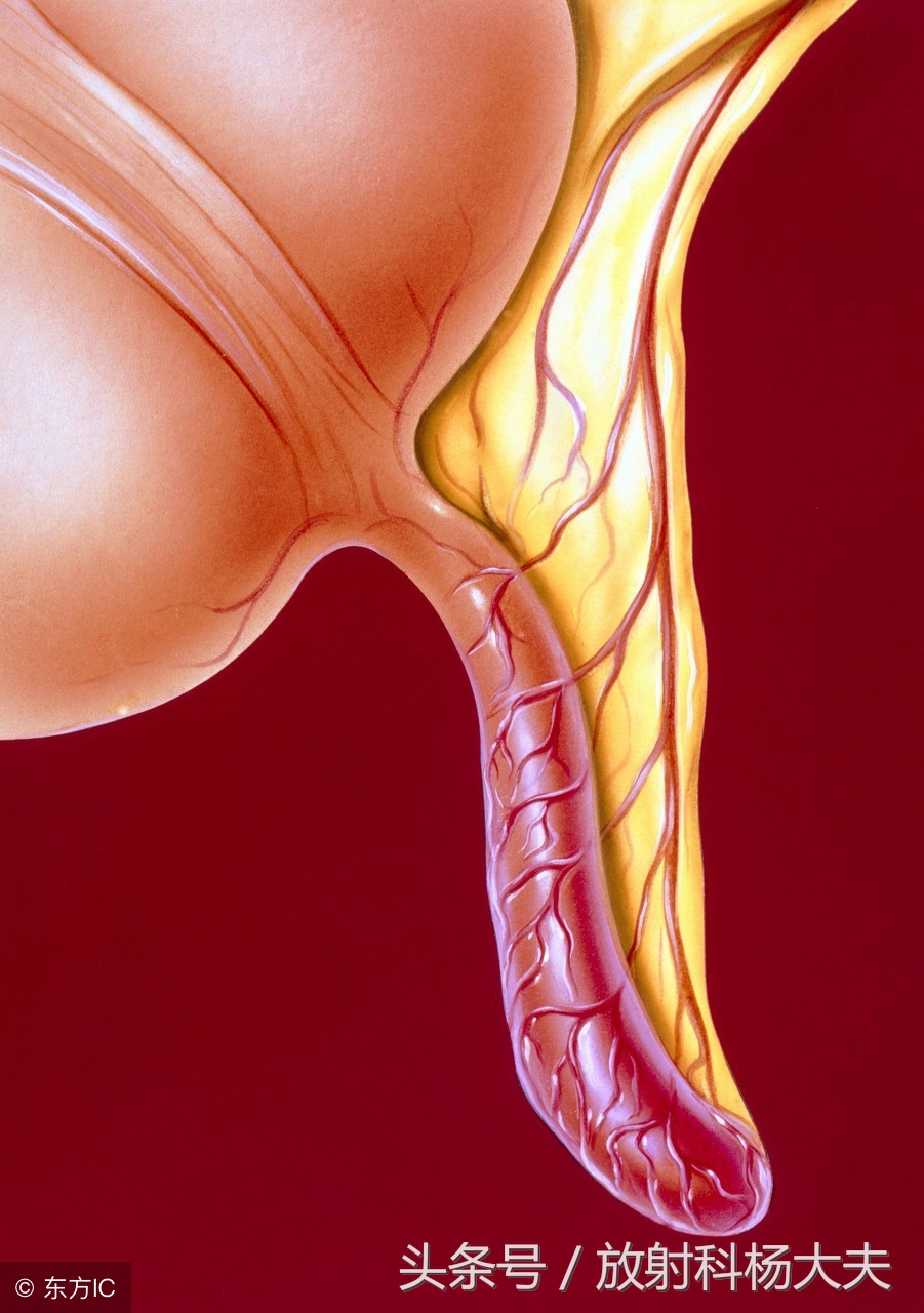 糟了，做腹部CT的那个女病人怀孕了，放射科大夫：没那么糟