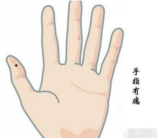 手指长痣的位置示意图图片