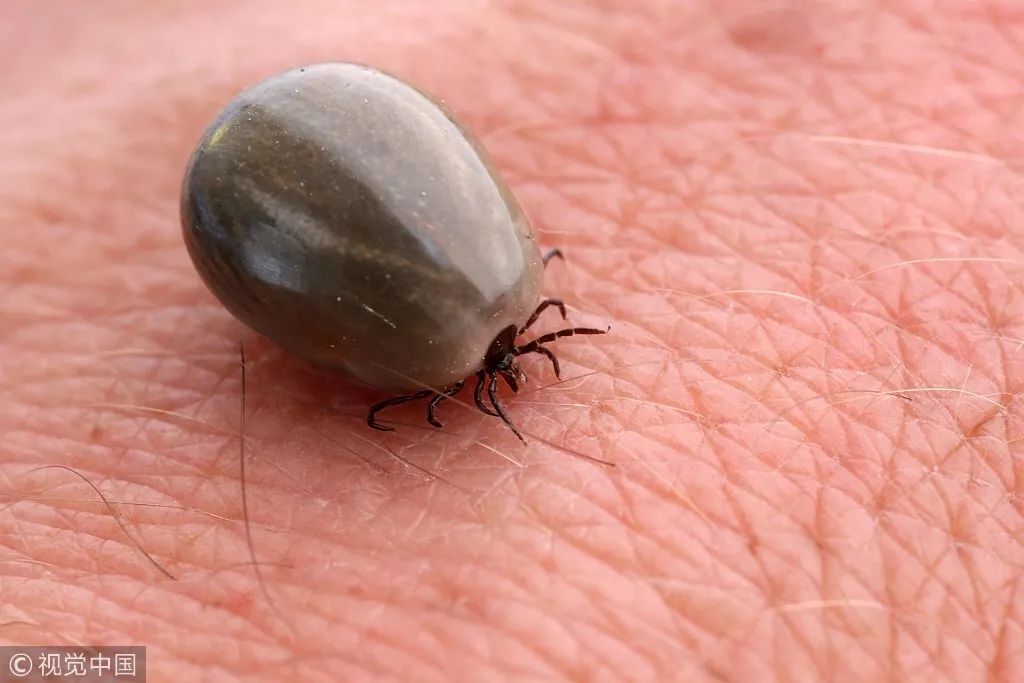 记得小时候看的一部电影,在森林里一个男子不知不觉得被水蛭吸满后背