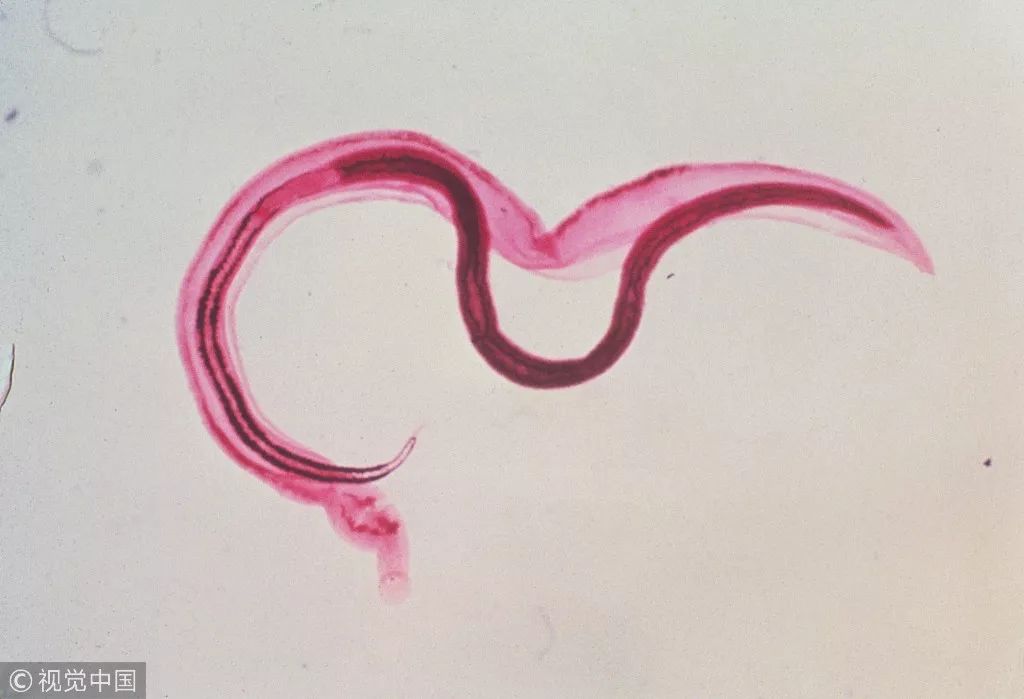 放个血吸虫都是爱你的形状隐翅虫严格意义上说不是寄生虫,但是他也是