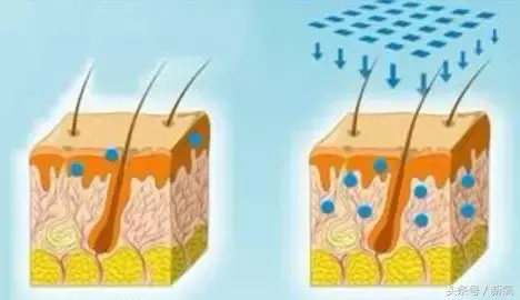能祛斑祛痘去皱纹?微针到底是护肤扛把子还是装X王?