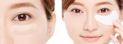 能祛斑祛痘去皱纹?微针到底是护肤扛把子还是装X王?