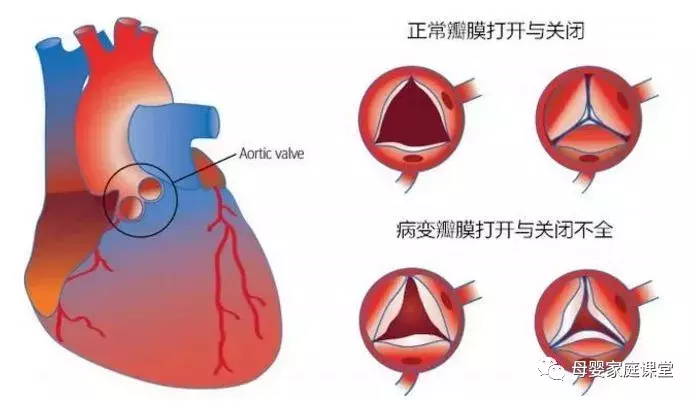 解密心脏杂音：宝宝心脏里的异常声音