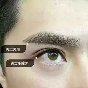 杭州一20多岁时髦小伙上午做完韩式美瞳线,下午就进了医院