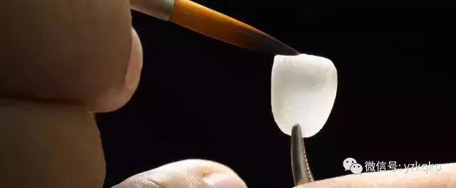 能让牙齿快速变美的牙贴面,是否适合你?葉子口腔科普