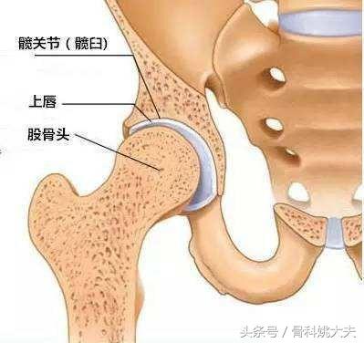 拍片髋关节一切正常但是股骨头痛是怎么回事？