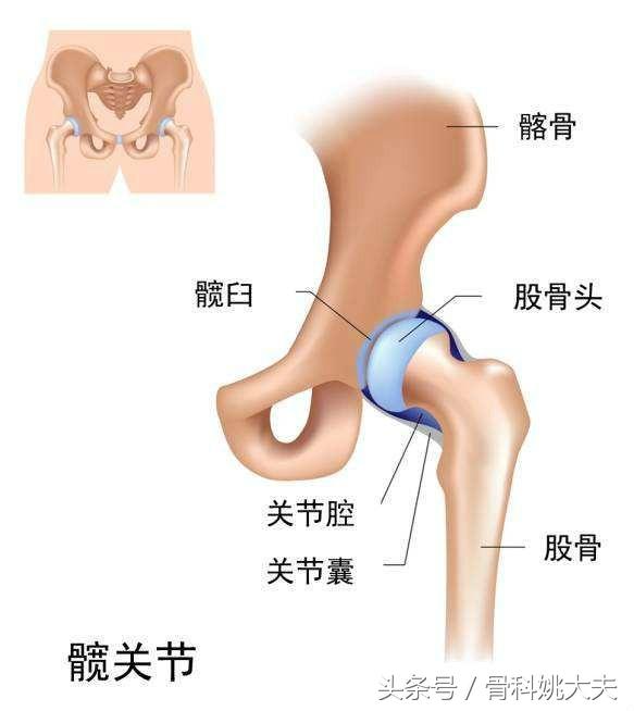 拍片髋关节一切正常但是股骨头痛是怎么回事？