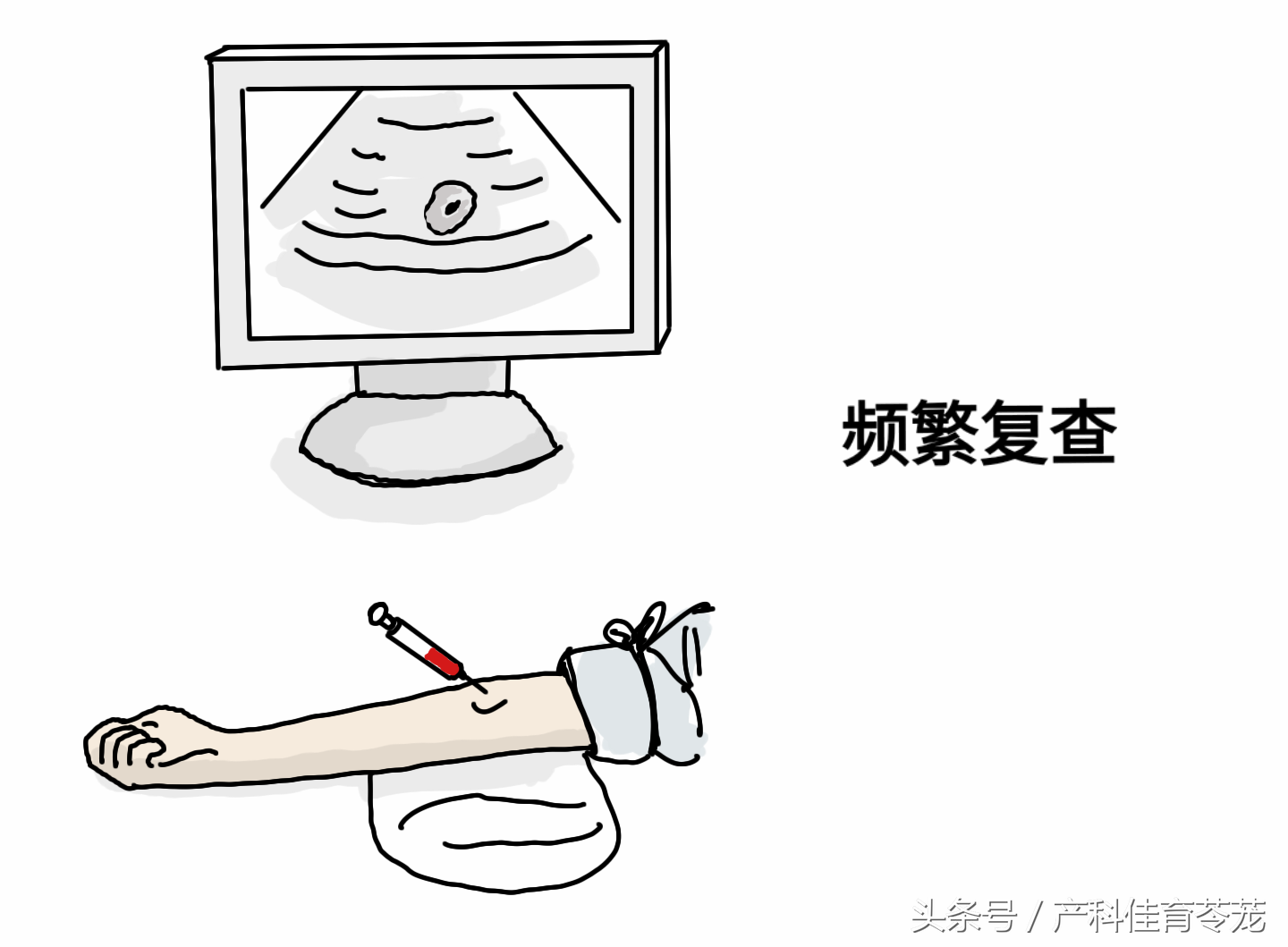 怀孕了，B超说子宫里有血，是不是要流产？