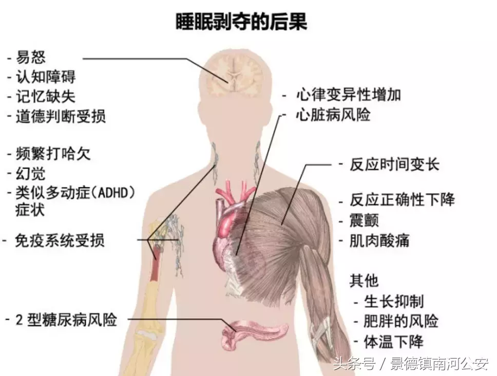 熬夜看世界杯的男人伤不起(28岁小伙熬夜看世界杯猝死：这个世界正在狠狠惩罚晚睡的人！)