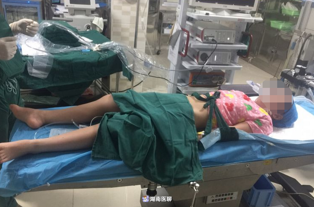 肾结石多发且复杂,泌尿外科团队进行了严谨的术前讨论,制定了手术方案