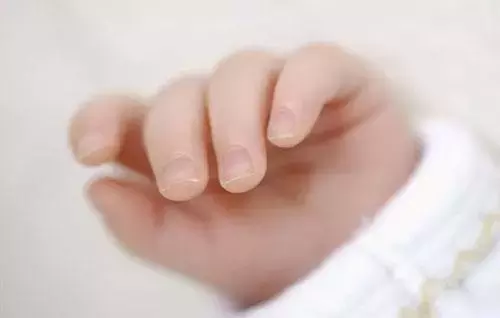 宝宝指甲透露出健康状况！长倒刺、有凹痕要警惕这些病！