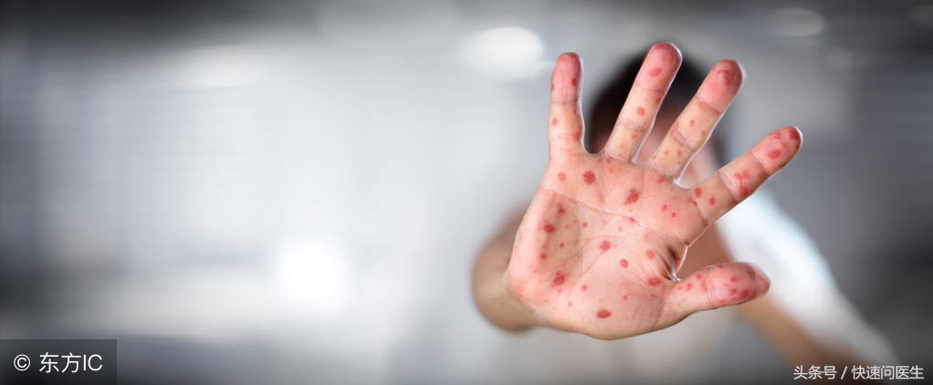 梅毒阳性是什么意思怎么治疗(梅毒阳性是什么意思会不会传染)-友友