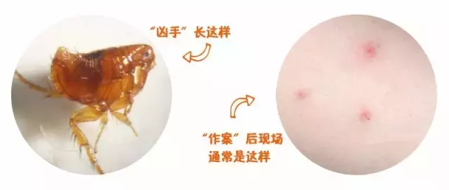 蚊虫咬一口,宝宝身上红肿一大片,医生说,夏季警惕虫咬性皮炎