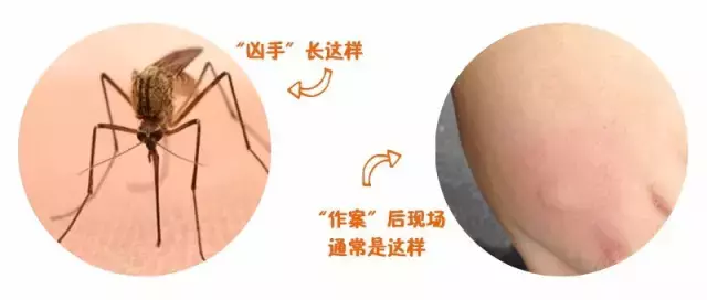 蚊虫咬一口,宝宝身上红肿一大片,医生说,夏季警惕虫咬性皮炎