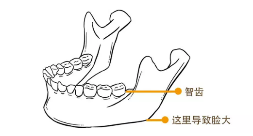 智齿在哪个位置图(智齿为什么叫做智齿你知道吗？是否一定得拔掉，不拔会脸大吗？)