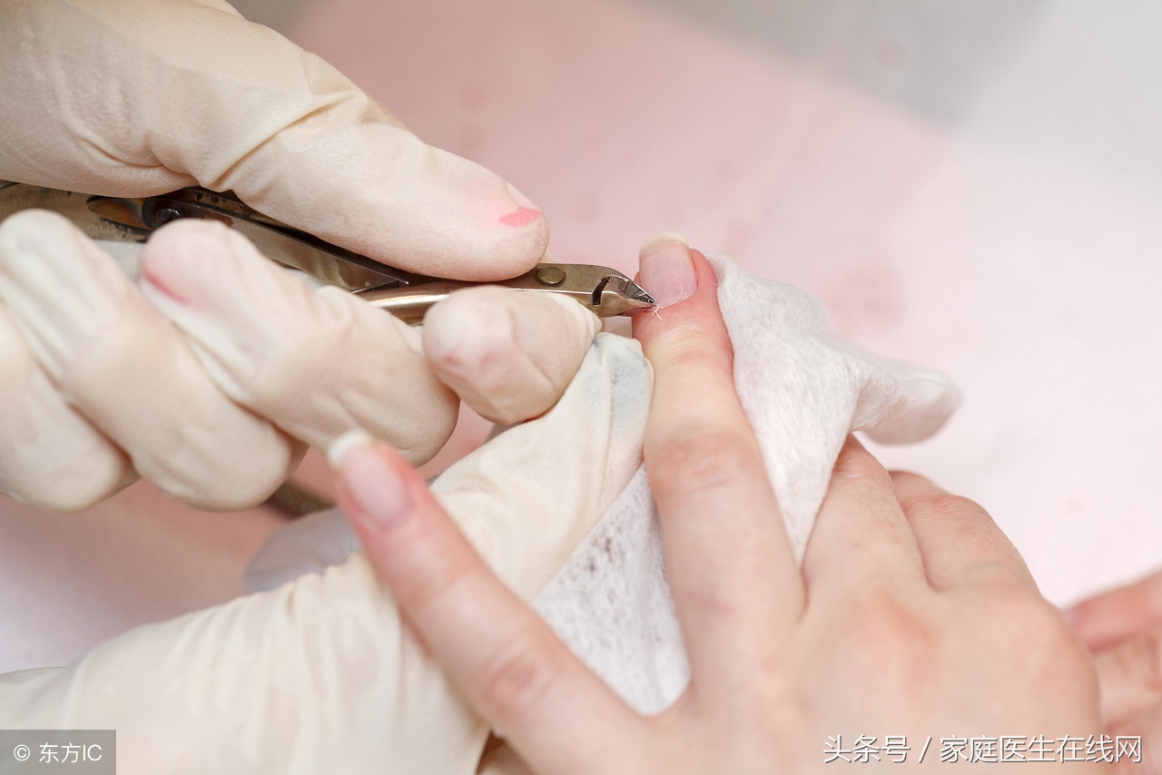 指甲凹陷就是生病了？医生：别胡乱猜想，可能是这7个原因引起！
