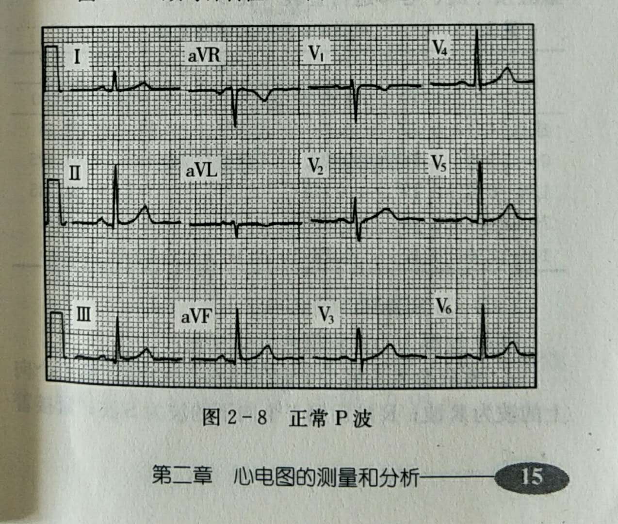 心电图多少算正常（心电图多少算正常图片）-第1张图片-华展网